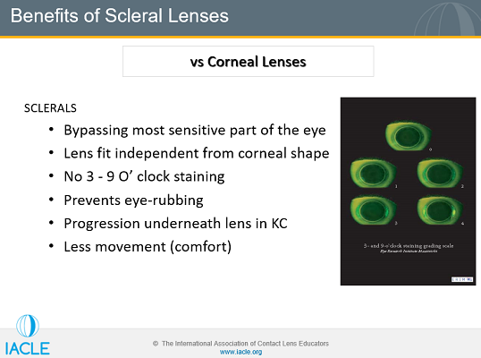 Iacle Contact Lens Course Iacle